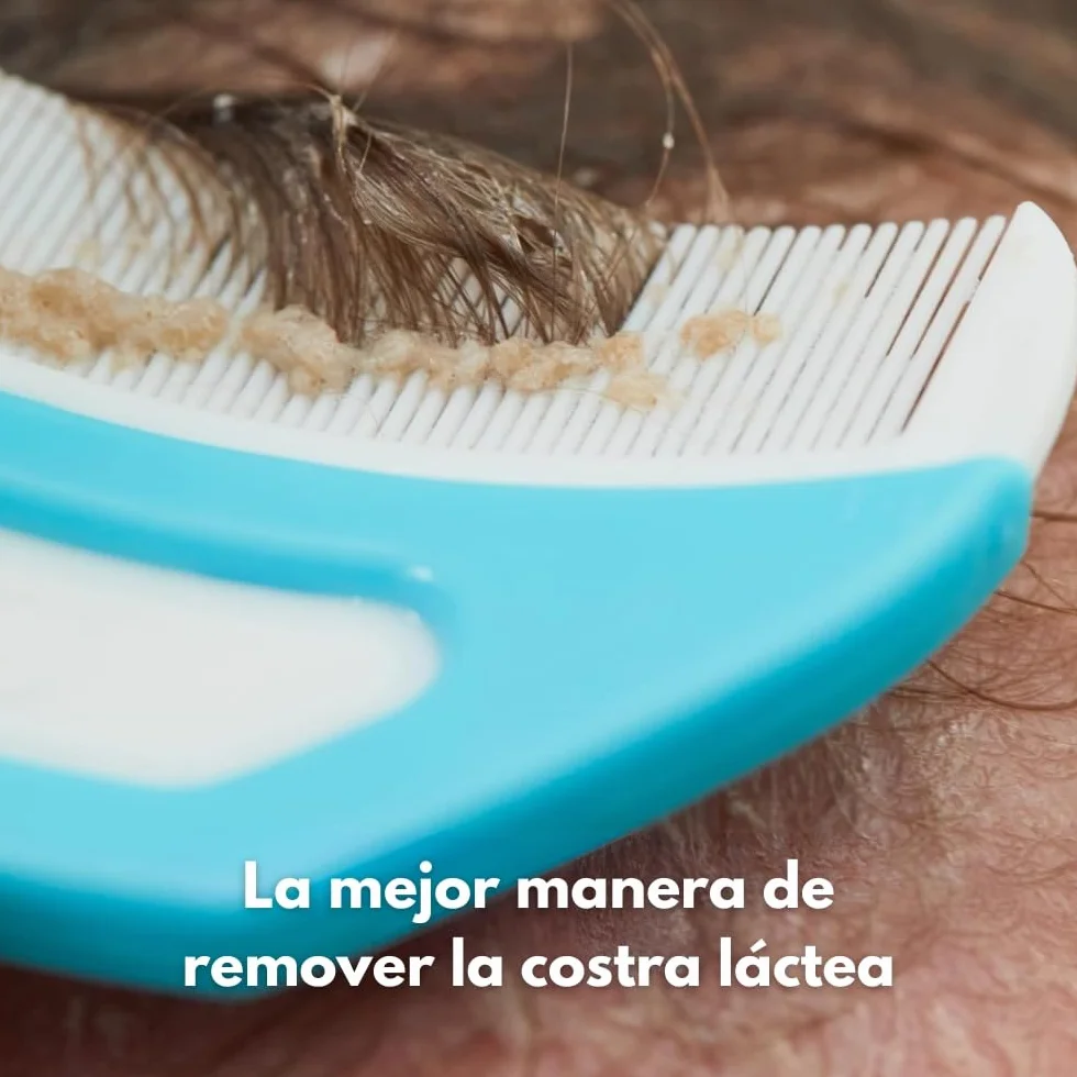 Frida Baby FlakeFixer – Kit trattamento per crosta lattea, 3 fasi, cura delicata per cuoio capelluto, con pettine e spugna inclusi
