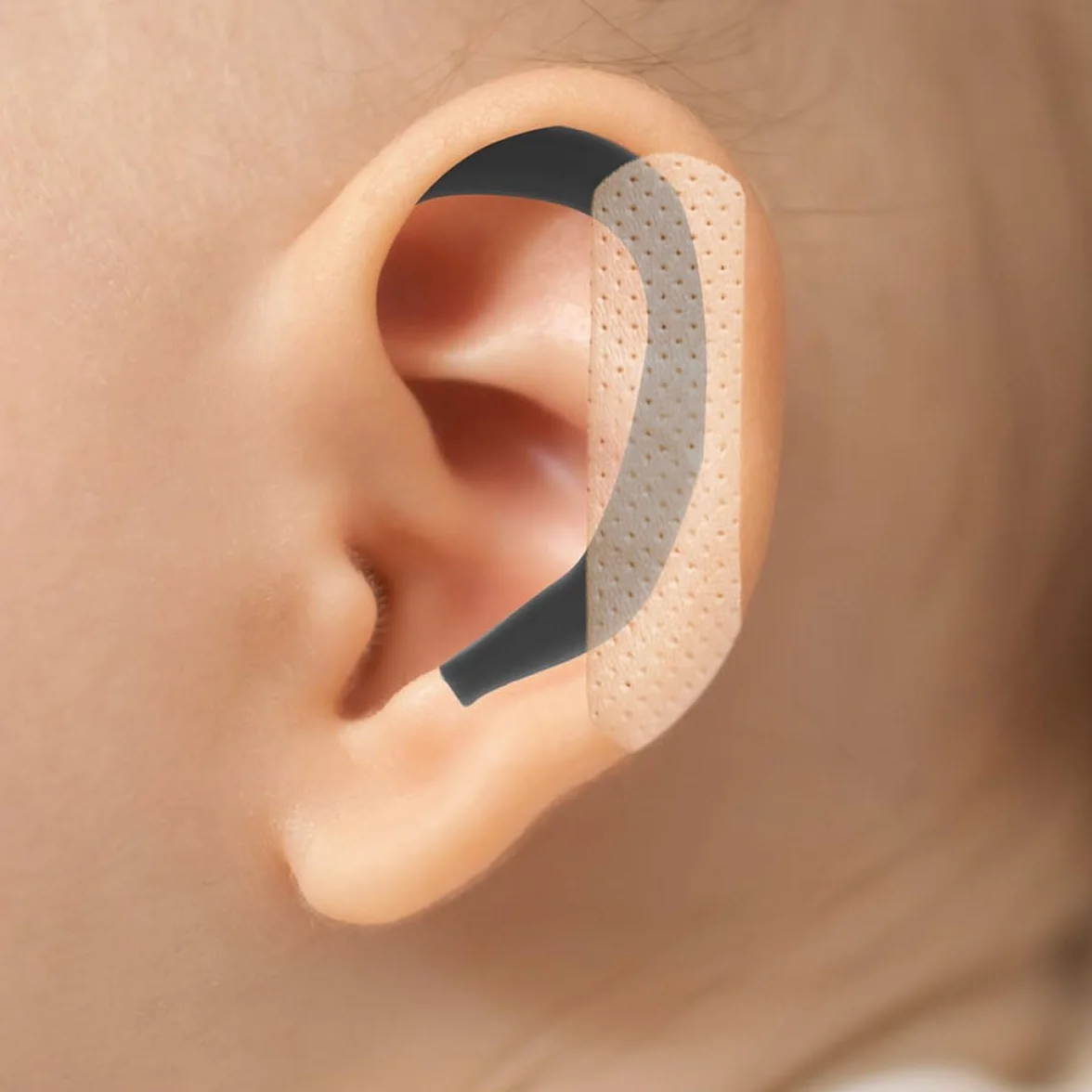 Correttore auricolare in silicone per neonati e bambini, correzione dell'orecchio sporgente per neonati e bambini, nero
