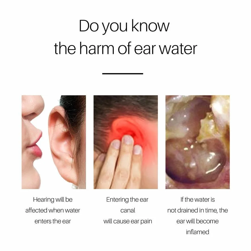 20 ml di gocce auricolari per la cura dell'otite media, gocce per il dolore all'orecchio, prurito, otite acuta, infezione batterica, rimozione, trattamento, pulizia del cerume