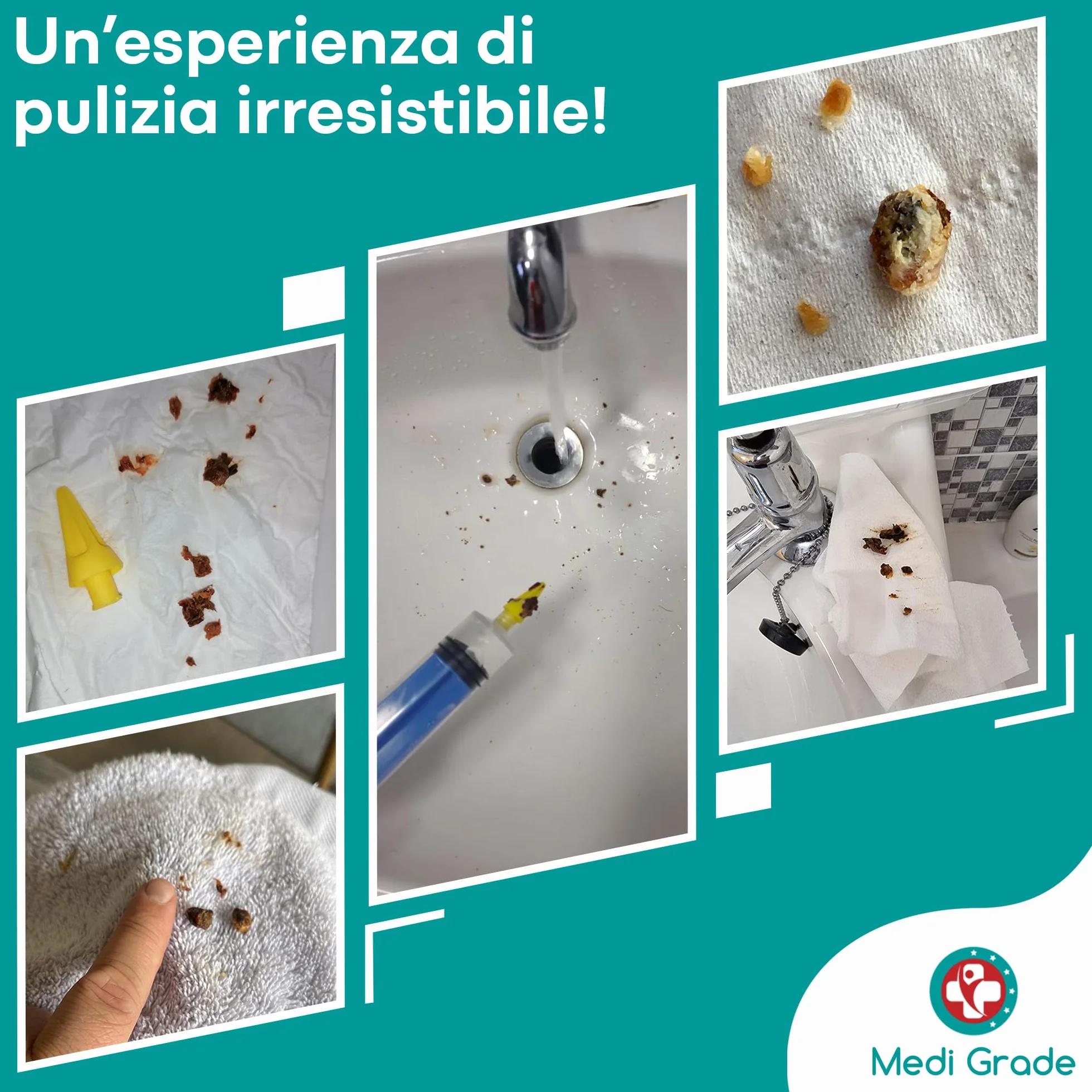 Kit Pulisci Orecchie – Pulizia Orecchie e Rimozione Cerume by Medi Grade – Kit per Pulire Orecchie con Siringa Orecchie da 60 ml con 3 Punte Quad-Stream