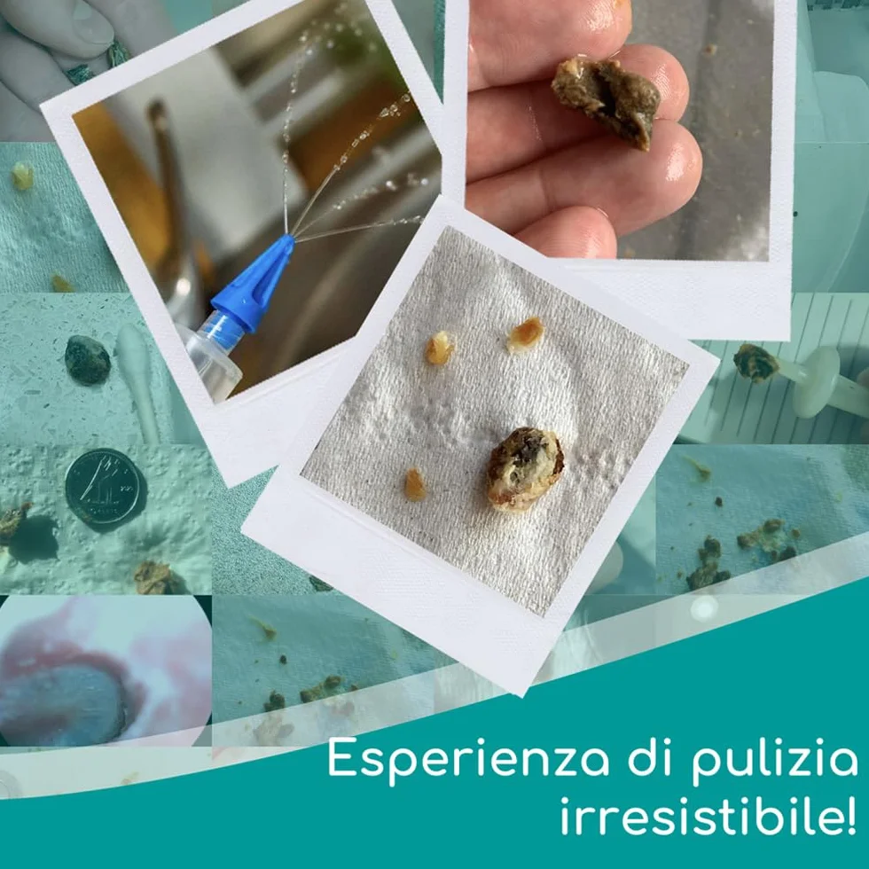 Medi Grade Kit Siringa Pulisci Orecchie – Siringa per Tappi Orecchie con 3 Punte a Getto Quadruplo –Kit per Pulizia Orecchie di Uso Domestico - Migliora la Chiarezza L’udito