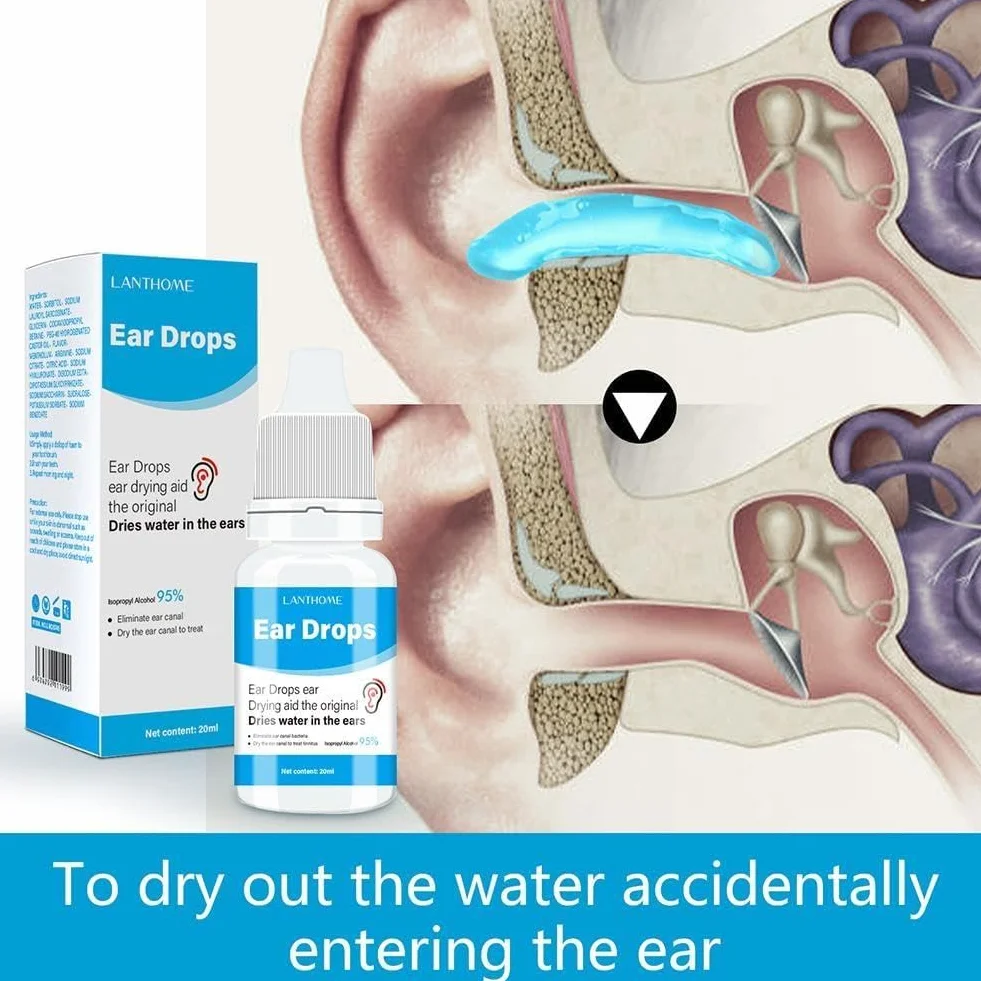 20 ml di gocce auricolari per la cura dell'otite media, gocce per il dolore all'orecchio, prurito, otite acuta, infezione batterica, rimozione, trattamento, pulizia del cerume