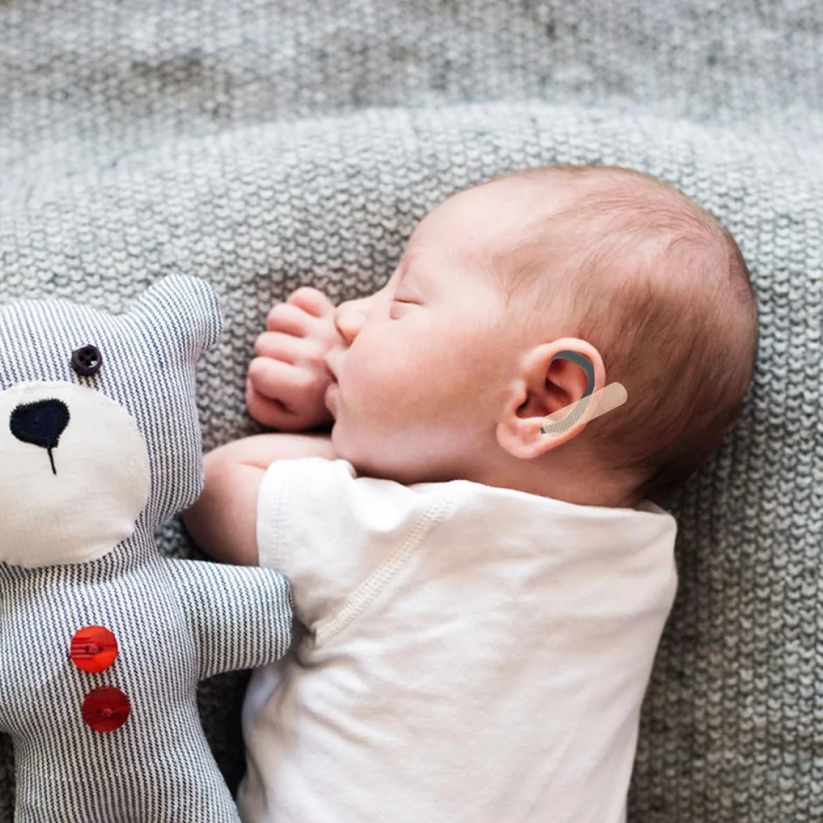 Correttore auricolare in silicone per neonati e bambini, correzione dell'orecchio sporgente per neonati e bambini, nero