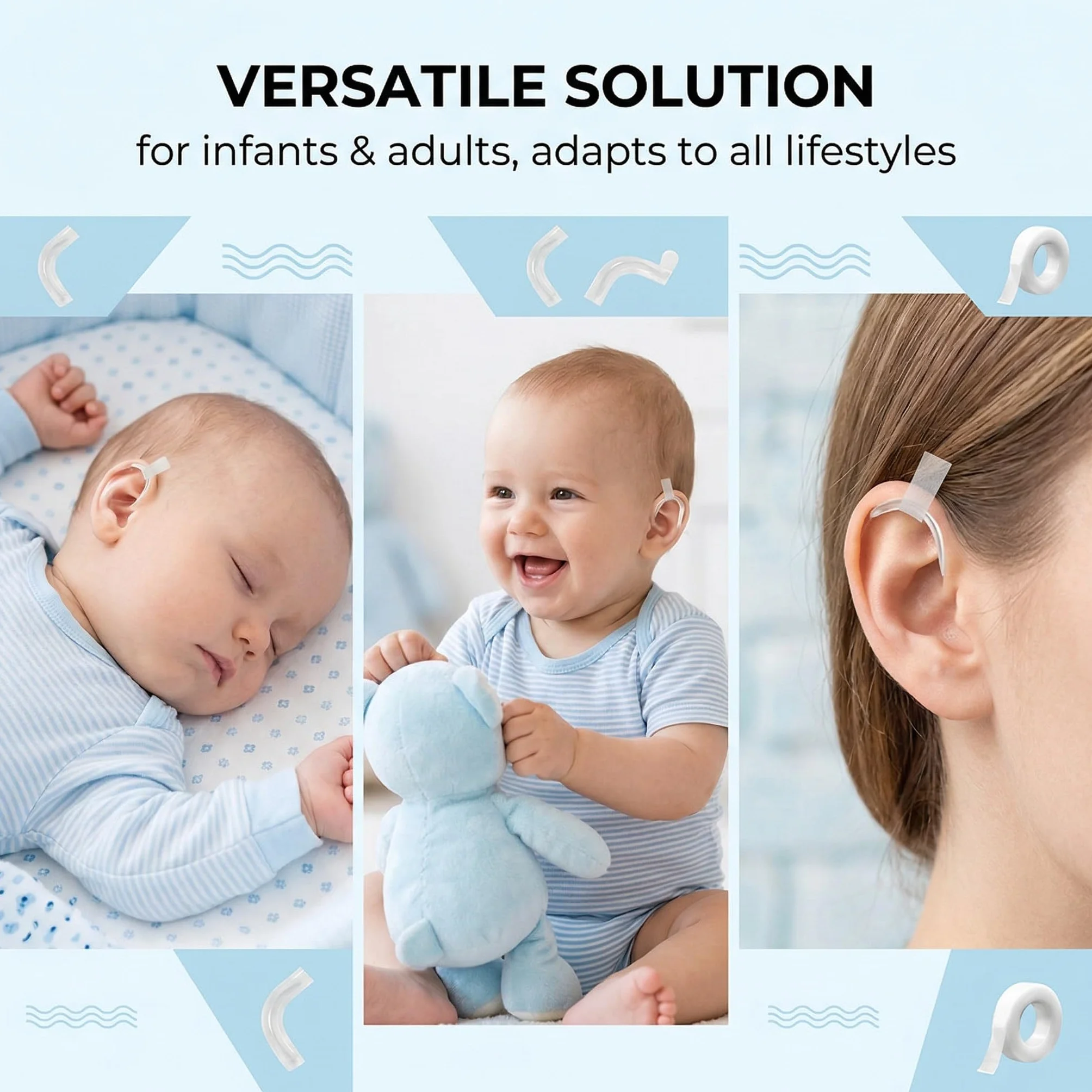 1 Paio Supporti Auricolari Modellabili In Silicone, Correttore Orecchie A Sventola, Cerotti Orecchie A Sventola Con Rullino