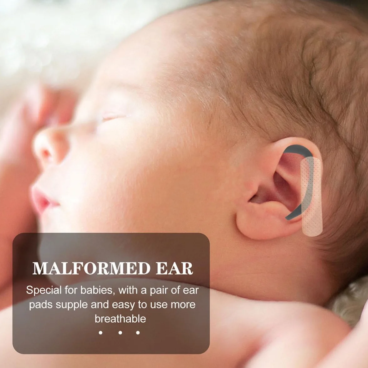 Correttore auricolare in silicone per neonati e bambini, correzione dell'orecchio sporgente per neonati e bambini, nero