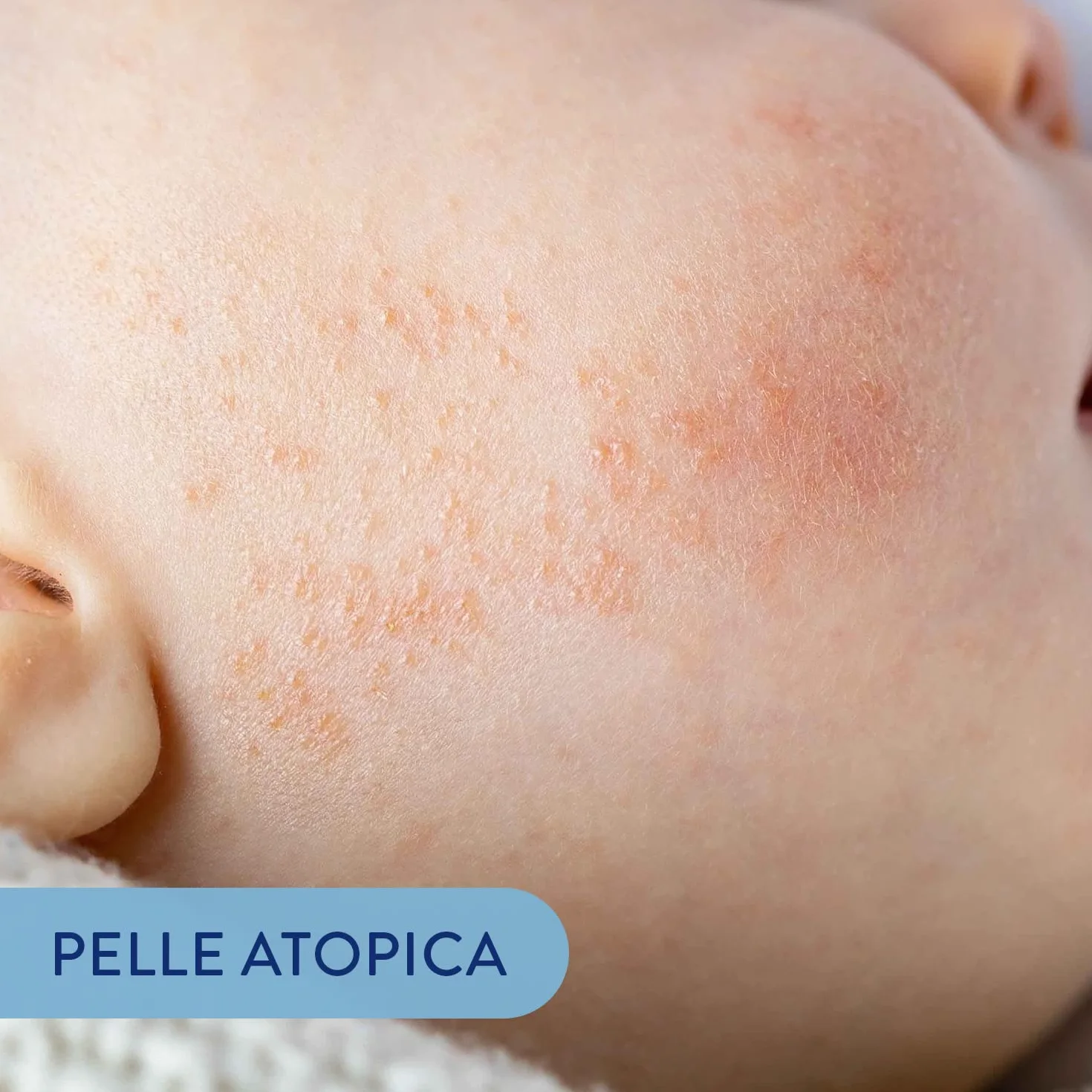 Babycoccole DERMO OLIO DA BAGNO per Bambini e Neonati. Per Pelle Sensibile e Dermatite Atopica. Delicato, Idratante, Protettivo, con Ingredienti Puri e Naturali. Dermatologicamente Testato. 150ml