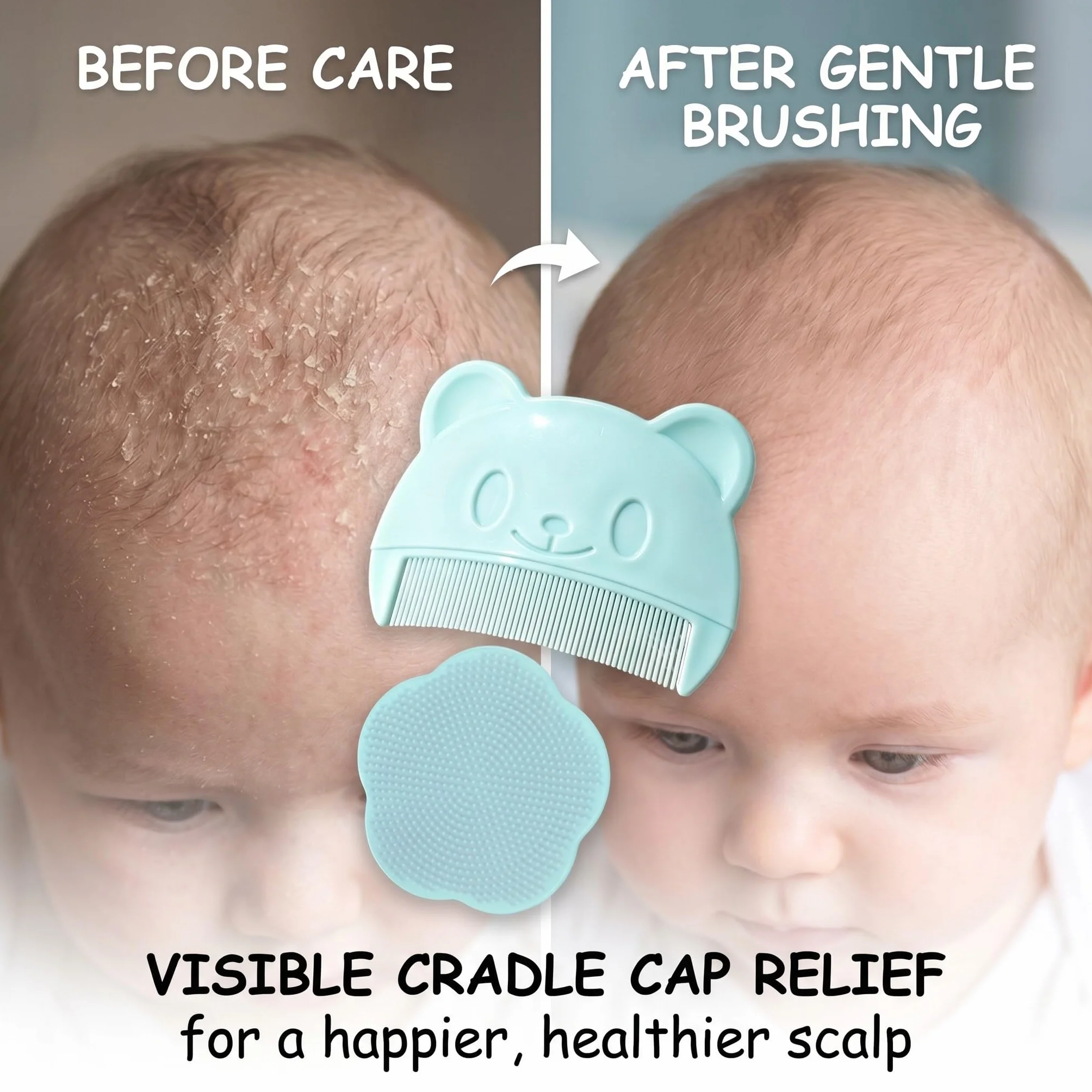 2 Pezzi Spazzola da Bagno per Neonati, pettine crosta lattea neonato, Spazzola per Bambini in Silicone, Pettine Neonato per Rimuovere La Crosta Lattea Del Bambino